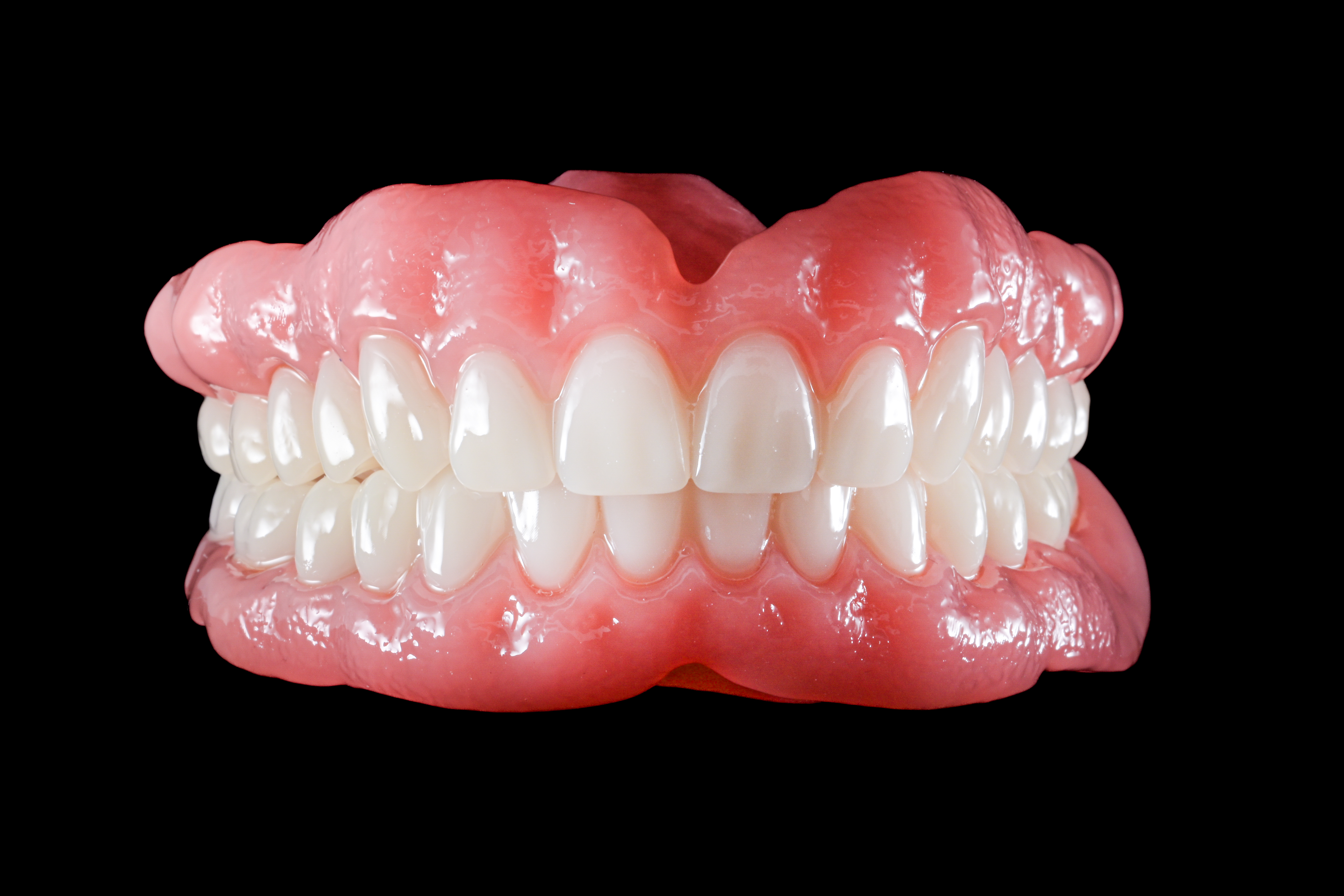 Dandy free intraoral scanner for Frontier customers